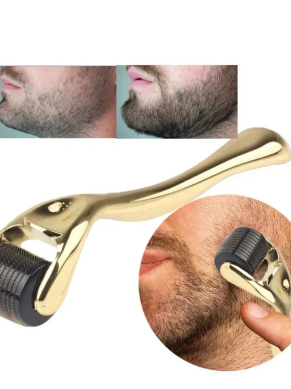 Derma Roller System Gold Microneedle Facial Roller